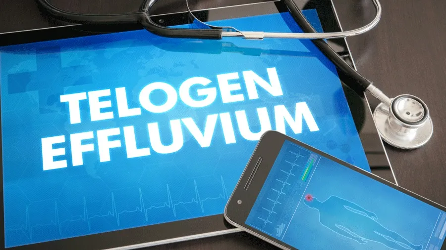 Telogen Effluvium: Află de Ce!